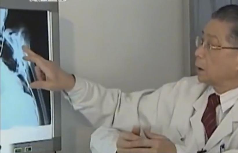 故事：大连39岁姑娘患怪病，皮肤坚硬宛如石膏，专家结论希望渺茫