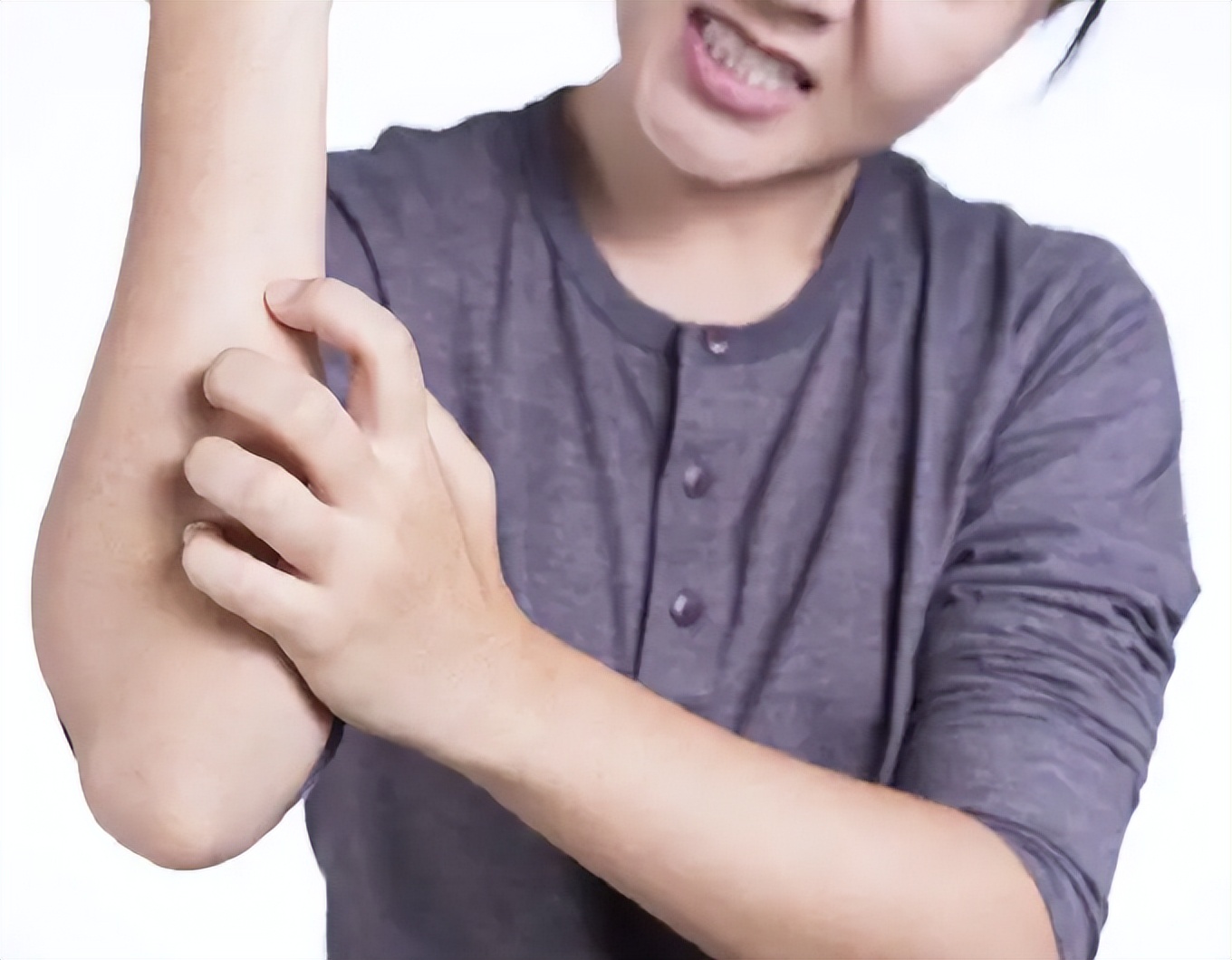 炉甘石万能药,万能止痒软膏配方