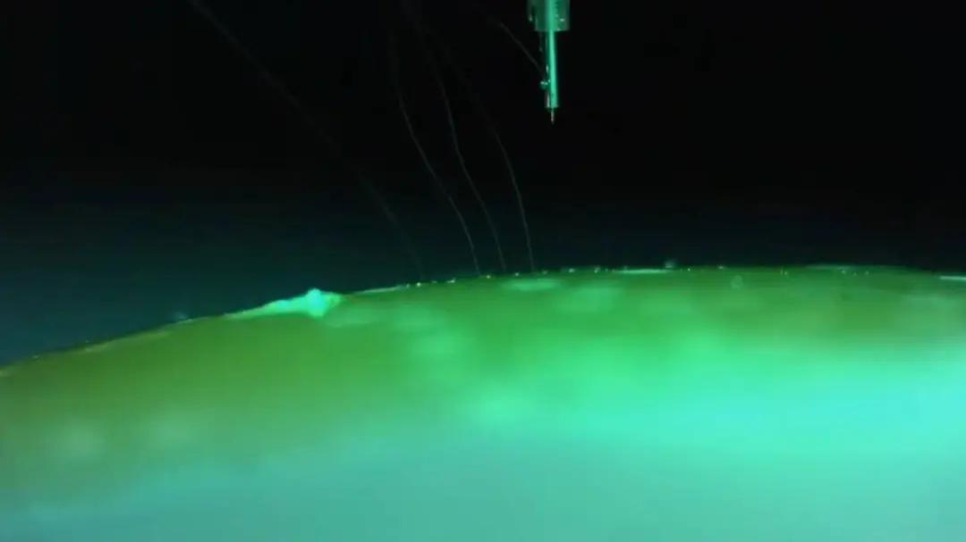 瑞士瘫痪男子,马斯克人脑接口芯片