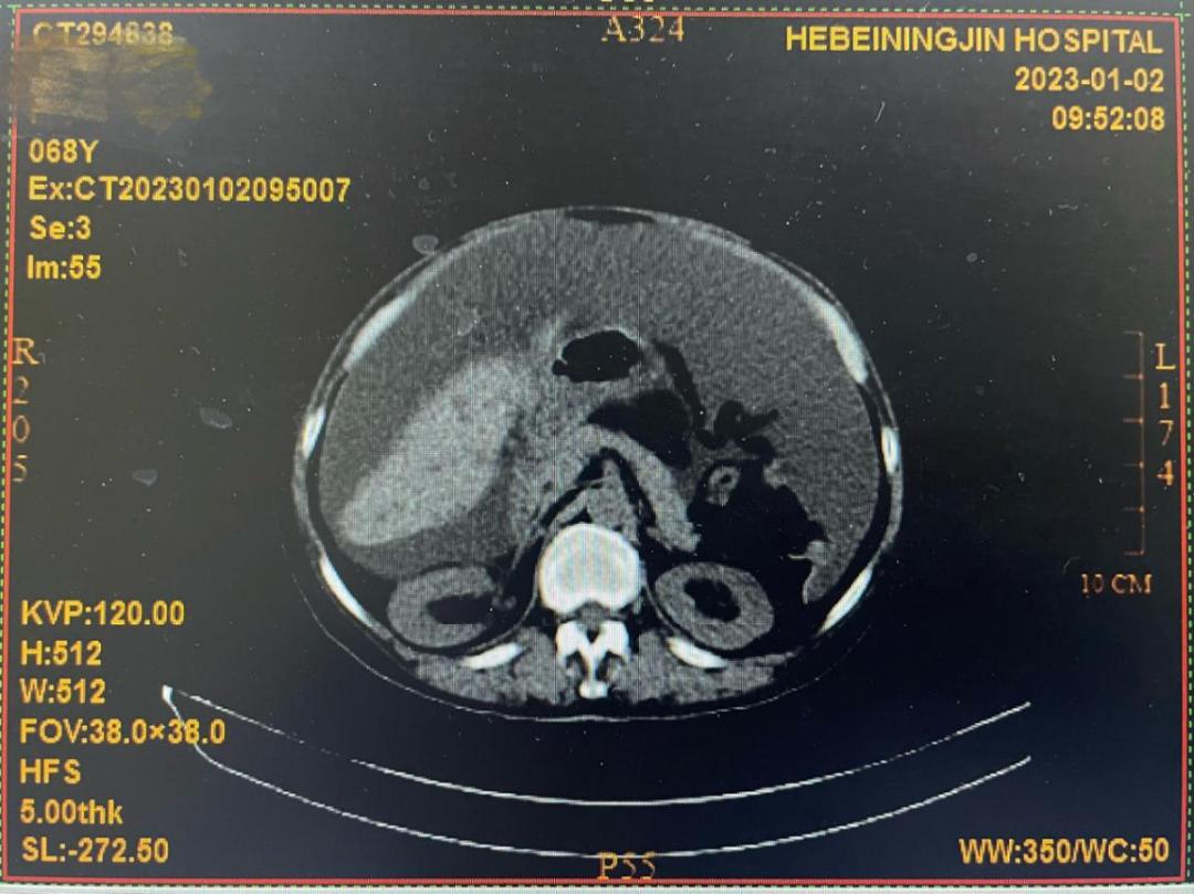 肿瘤君台词,肿瘤君电视剧
