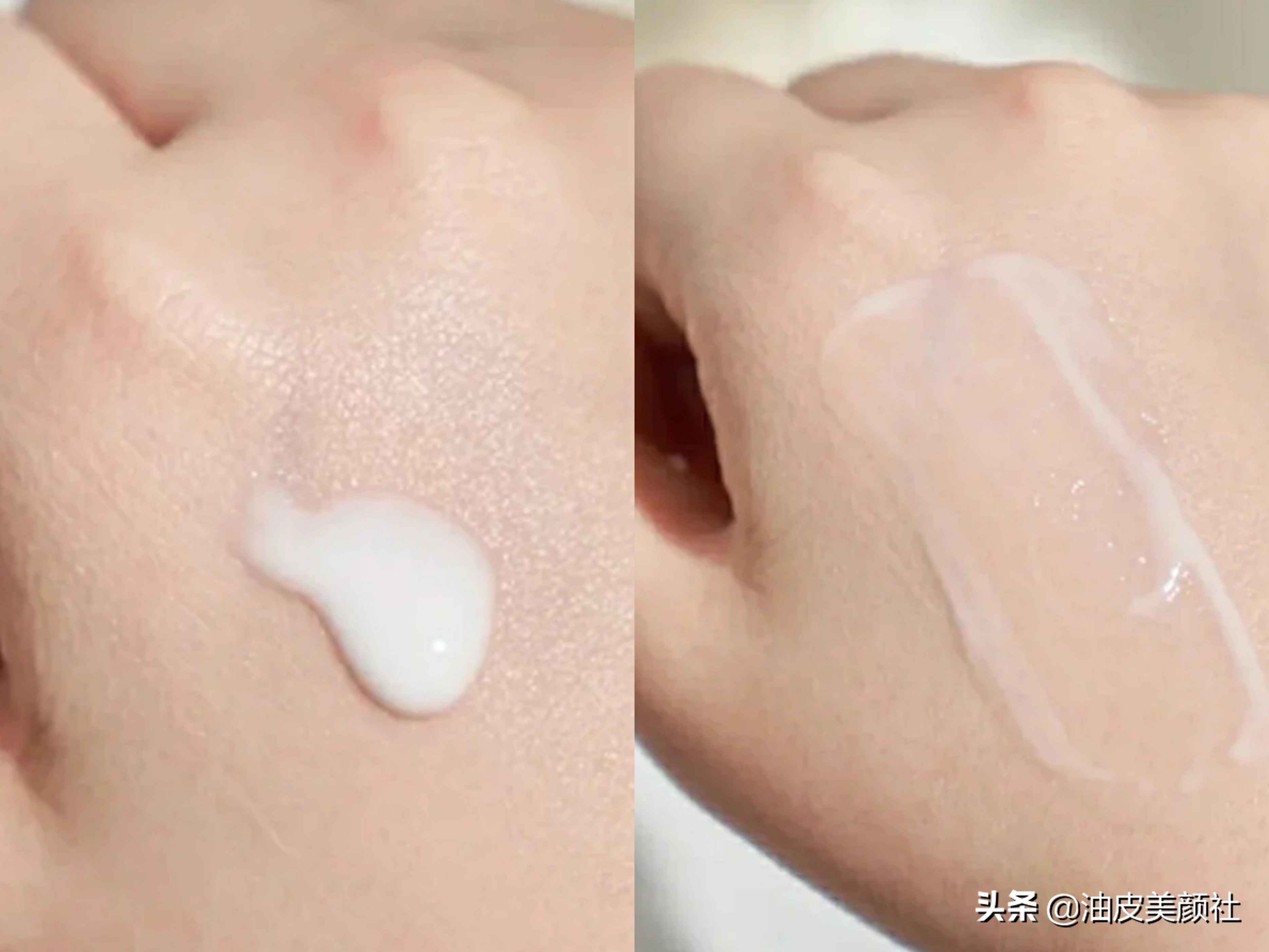 olay抗糖小白瓶和珀莱雅双抗精华,olay抗糖小白瓶和珀莱雅双抗谁好