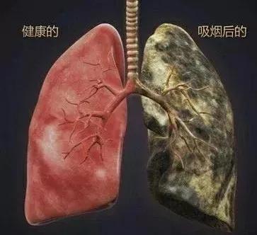 戒烟只需要坚持五天,戒烟十天症状