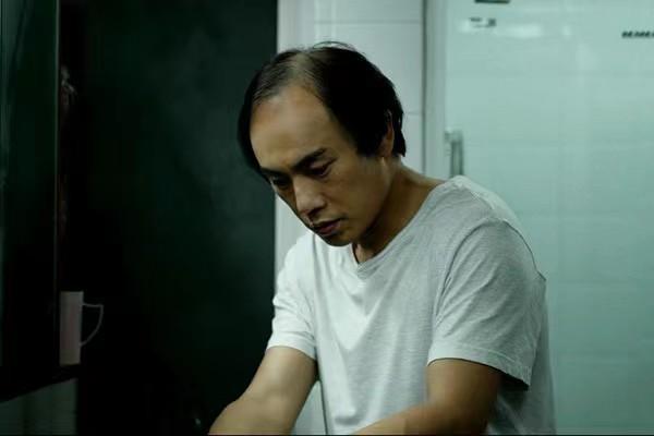 有哪些明星头发秃顶,秃顶明星发际线