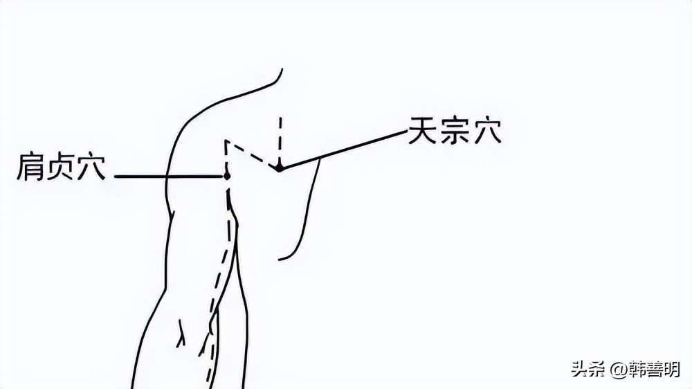 韩善明艾灸治疝气,韩善明熏蒸疗法