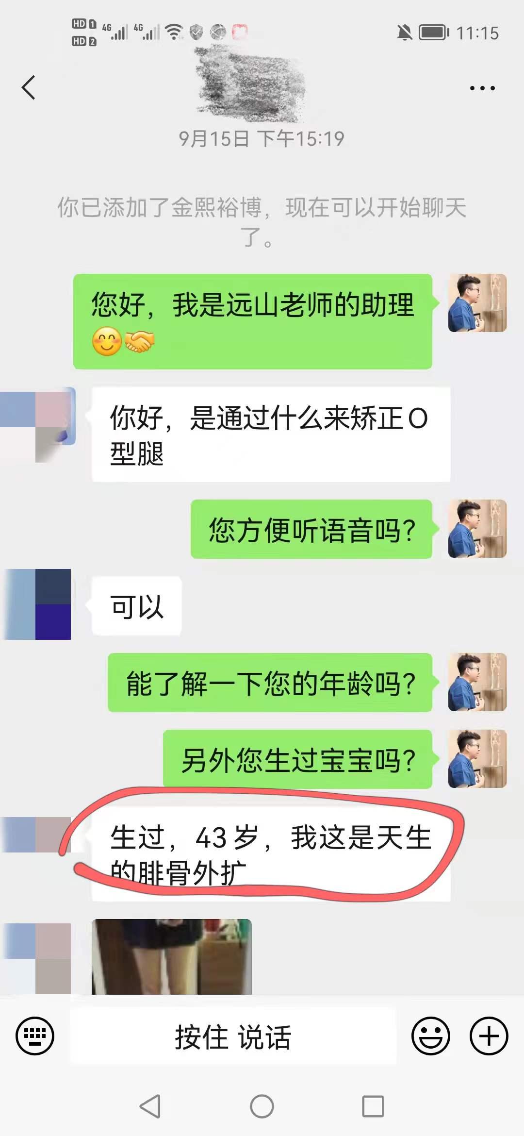 o型腿案例,宝妈o型腿