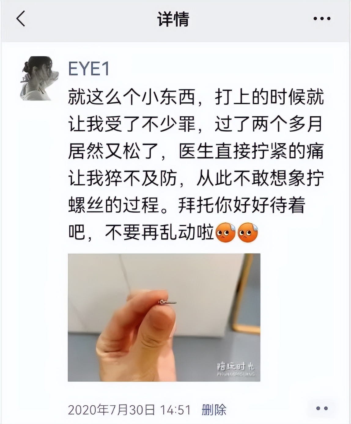 整牙亲身经历分享一下,整牙的经历分享
