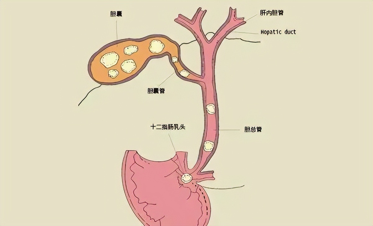 胃肠胀气引起的疼痛如何快速解决,胃肠胀疼