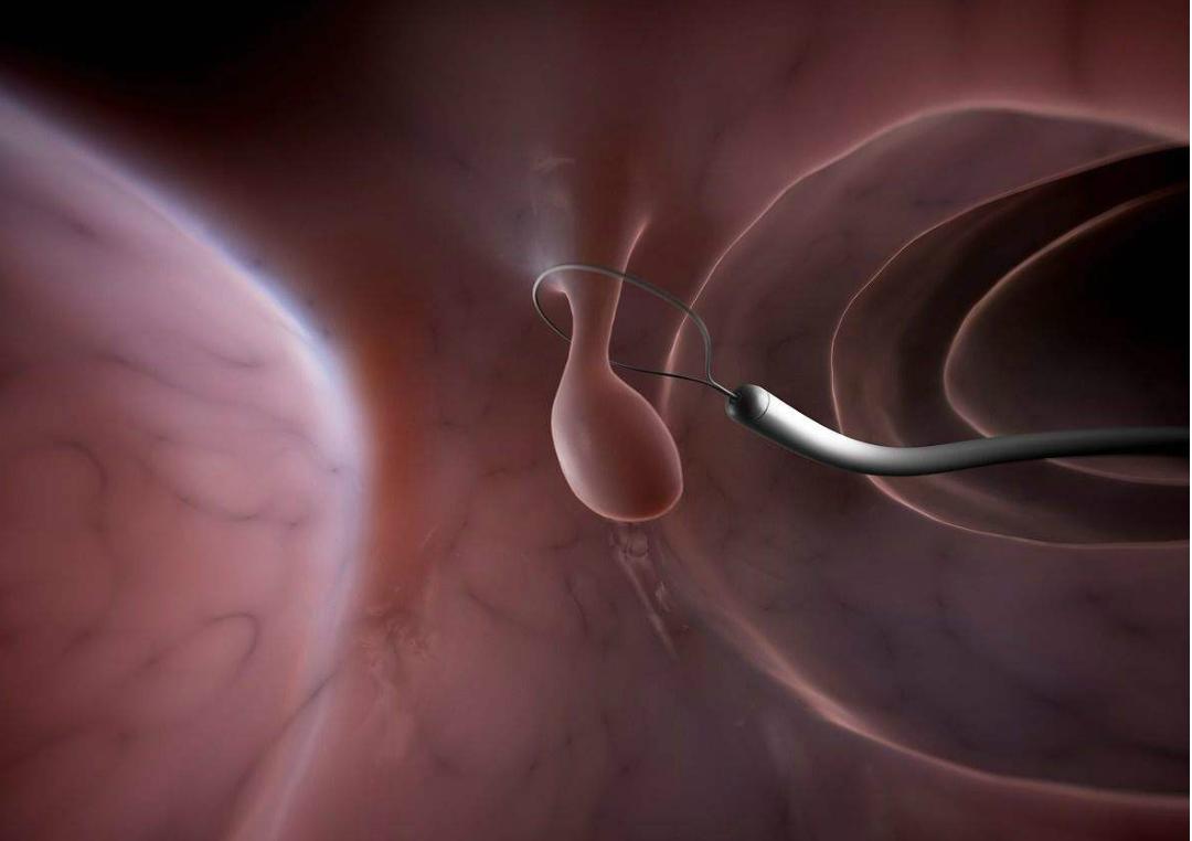 男医生做肠镜检查吗,男医生做肠镜会难为情不