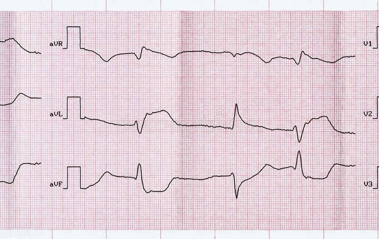 老人吃鸡蛋会得胆囊炎吗,老年人胆囊炎腹痛