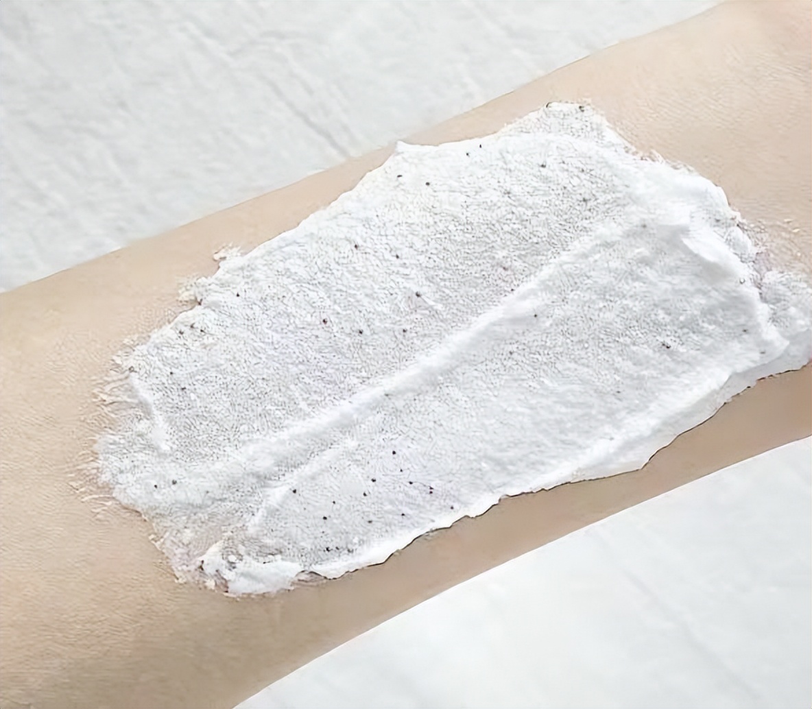 肥胖纹目前最好的去除办法,淡化肥胖纹修复肥胖纹