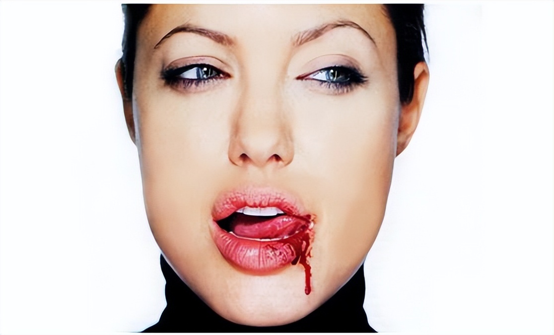 返老还童面霜骗局,换血抗衰老真的有用吗