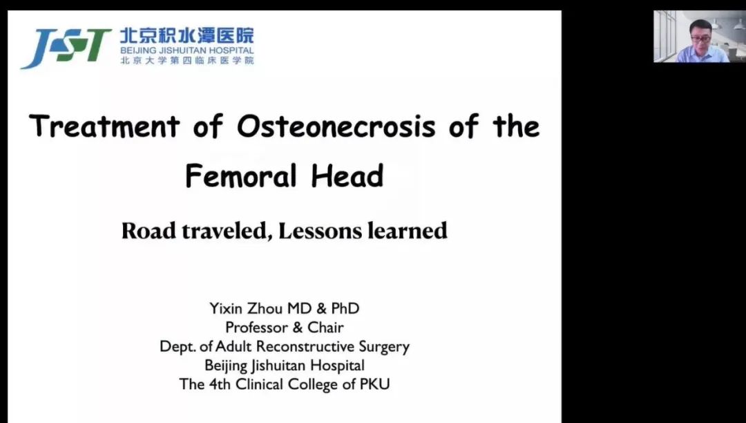 北京积水潭股骨头坏死二期专家,积水潭医院股骨头坏死宣传讲座