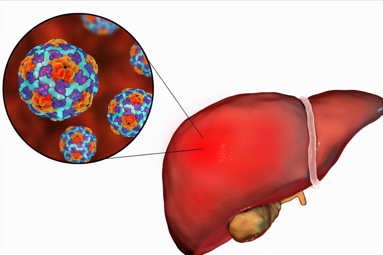 乙肝患者出现什么症状得注意,乙肝患者需要引起重视的情况