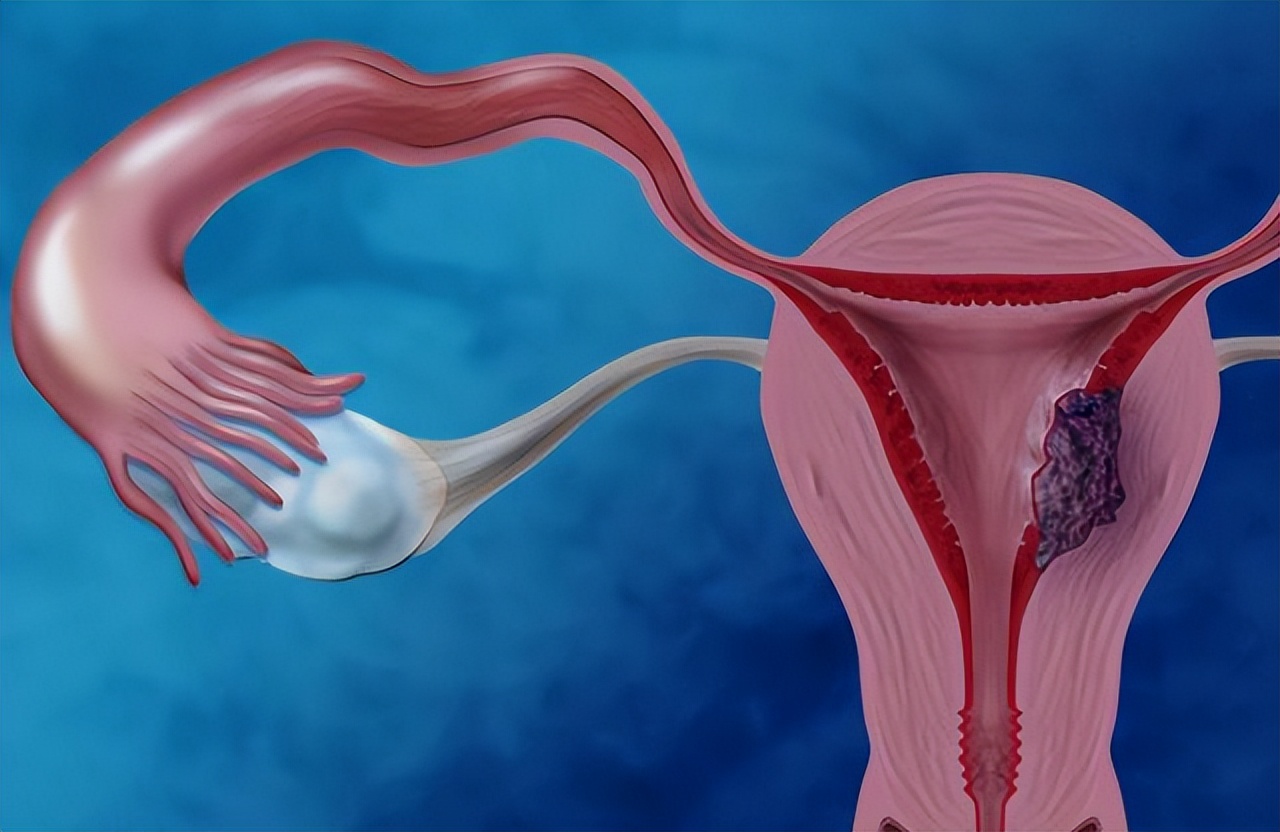 月经结束后为什么有褐色的分泌物,月经结束后10天有褐色膜状分泌物