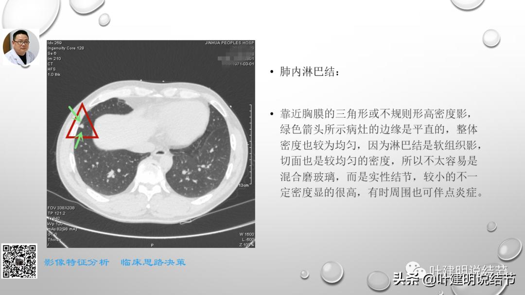 在《一脉阳光》呼吸影像诊断专题培训班上的讲课PPT（第一部分）