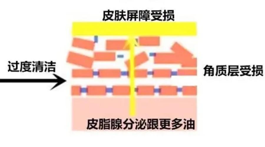 油脂分泌导致缺水什么意思,皮肤严重缺水油脂分泌旺盛