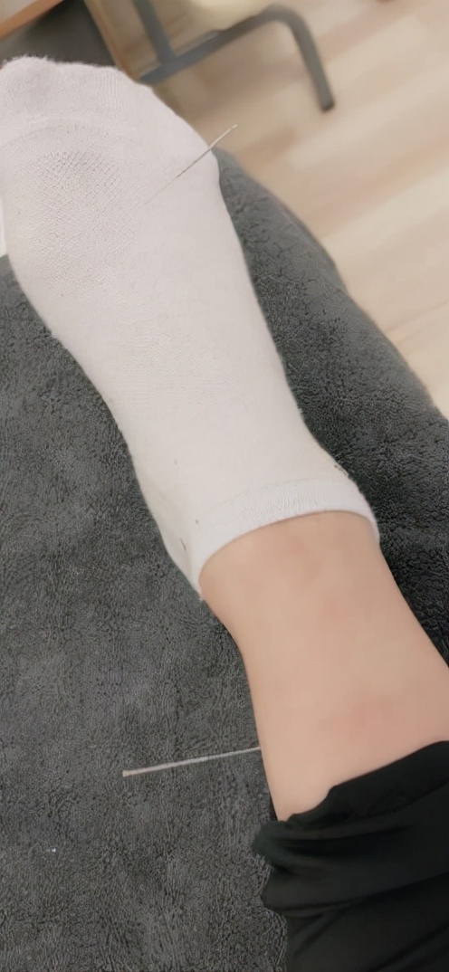 古派针灸,黄贵生针灸视频全集