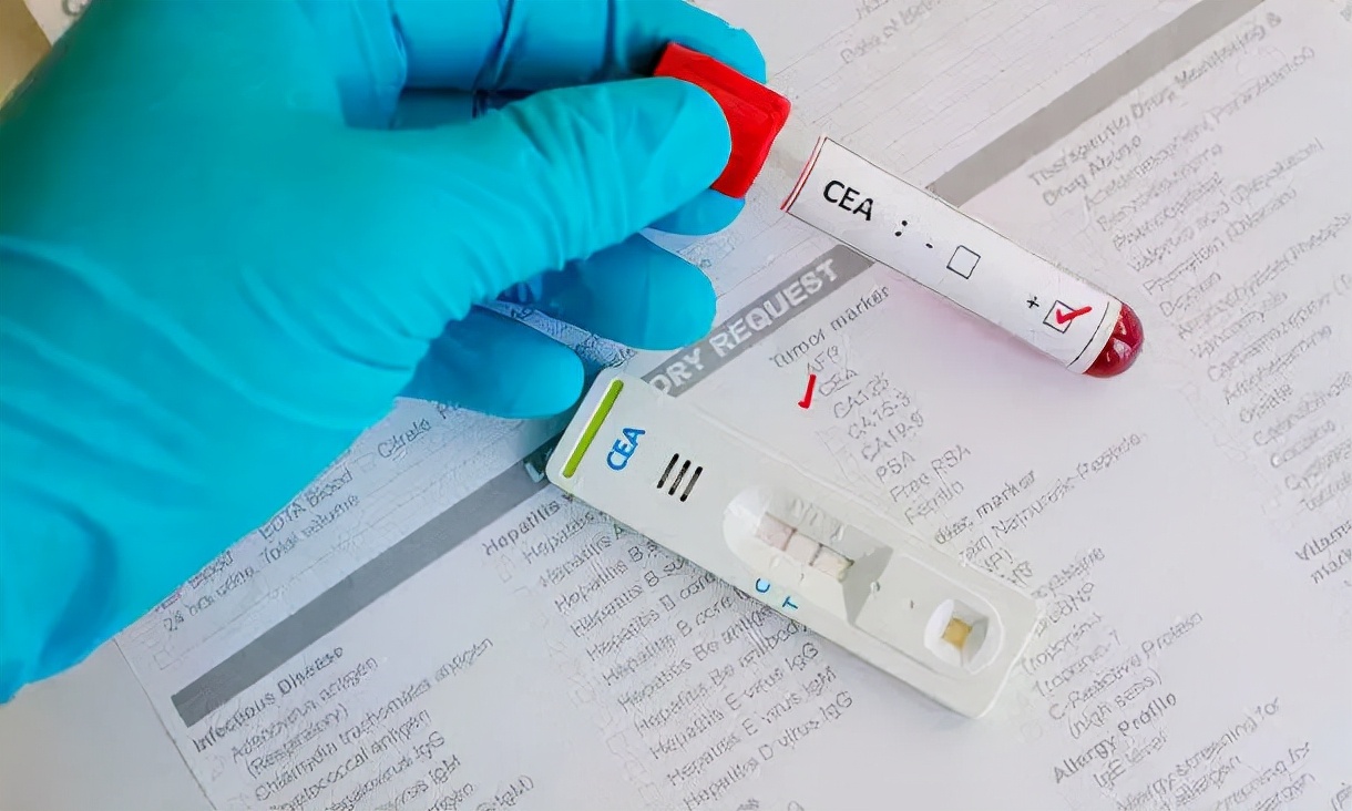 癌胚抗原升高多少可以显示癌症,癌症病人癌胚抗原升高说明什么