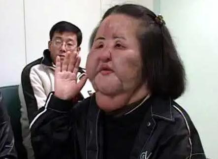全世界整容最失败的女人,盘点那些整容的女人