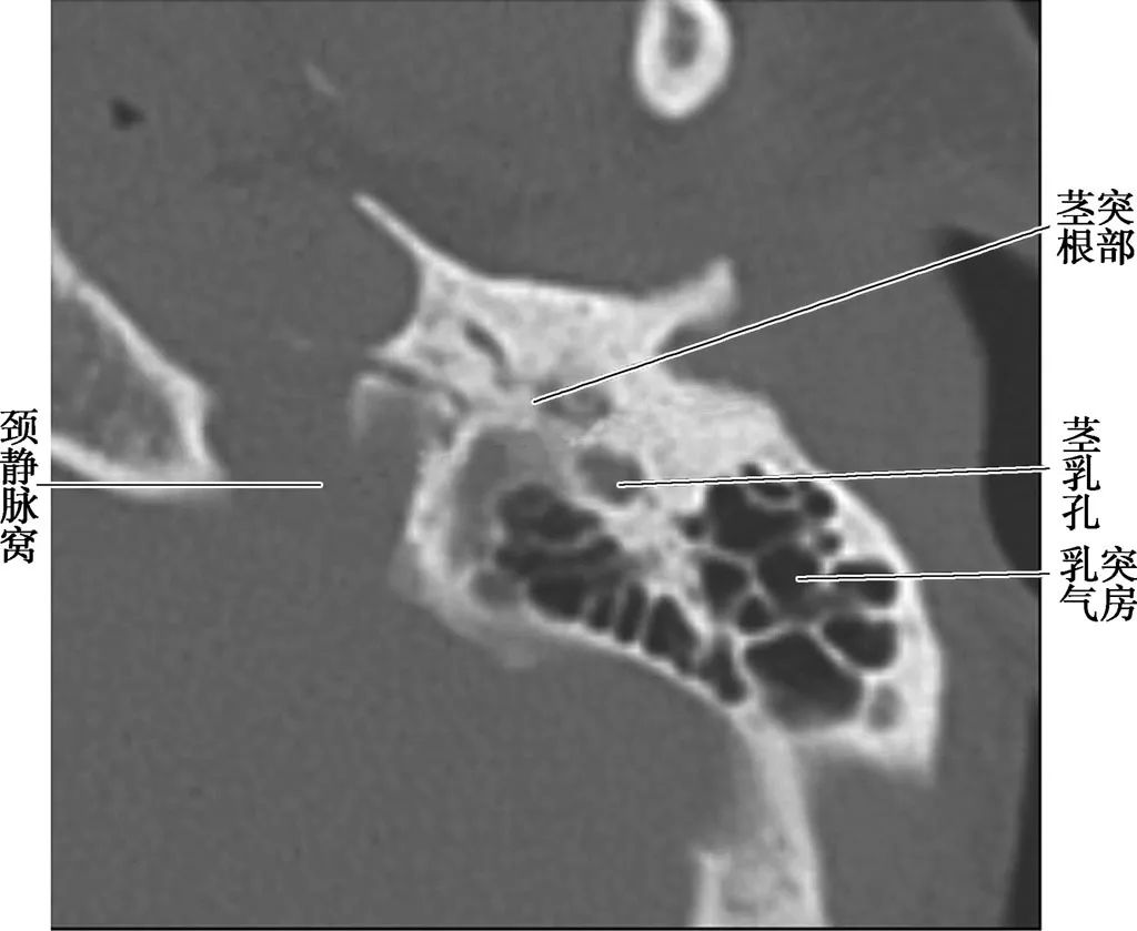 耳部解剖结构和生理功能,耳部解剖笔记