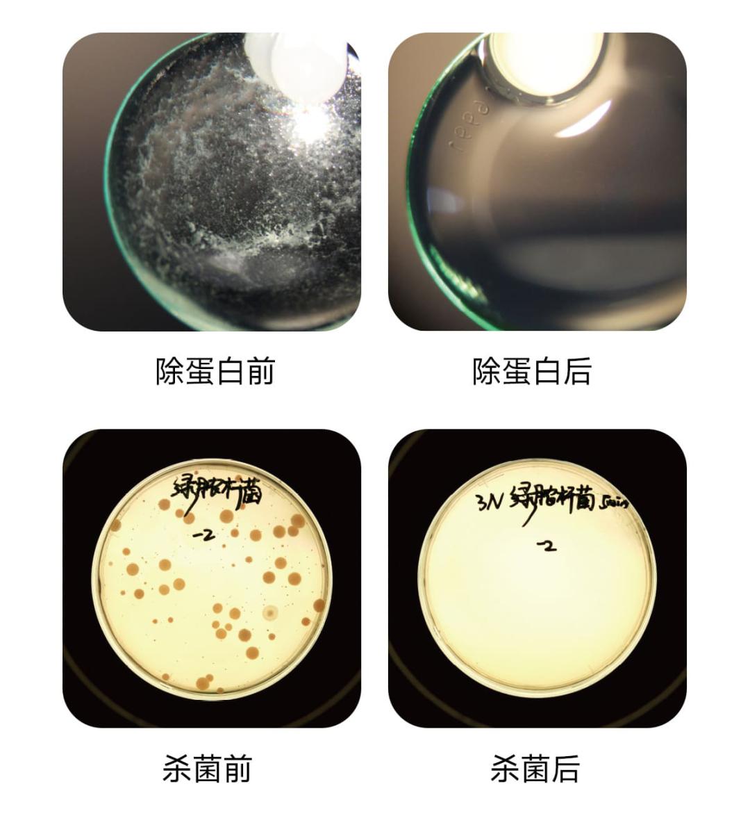 ok镜能控制眼轴增长吗,戴ok镜眼轴会不增长吗