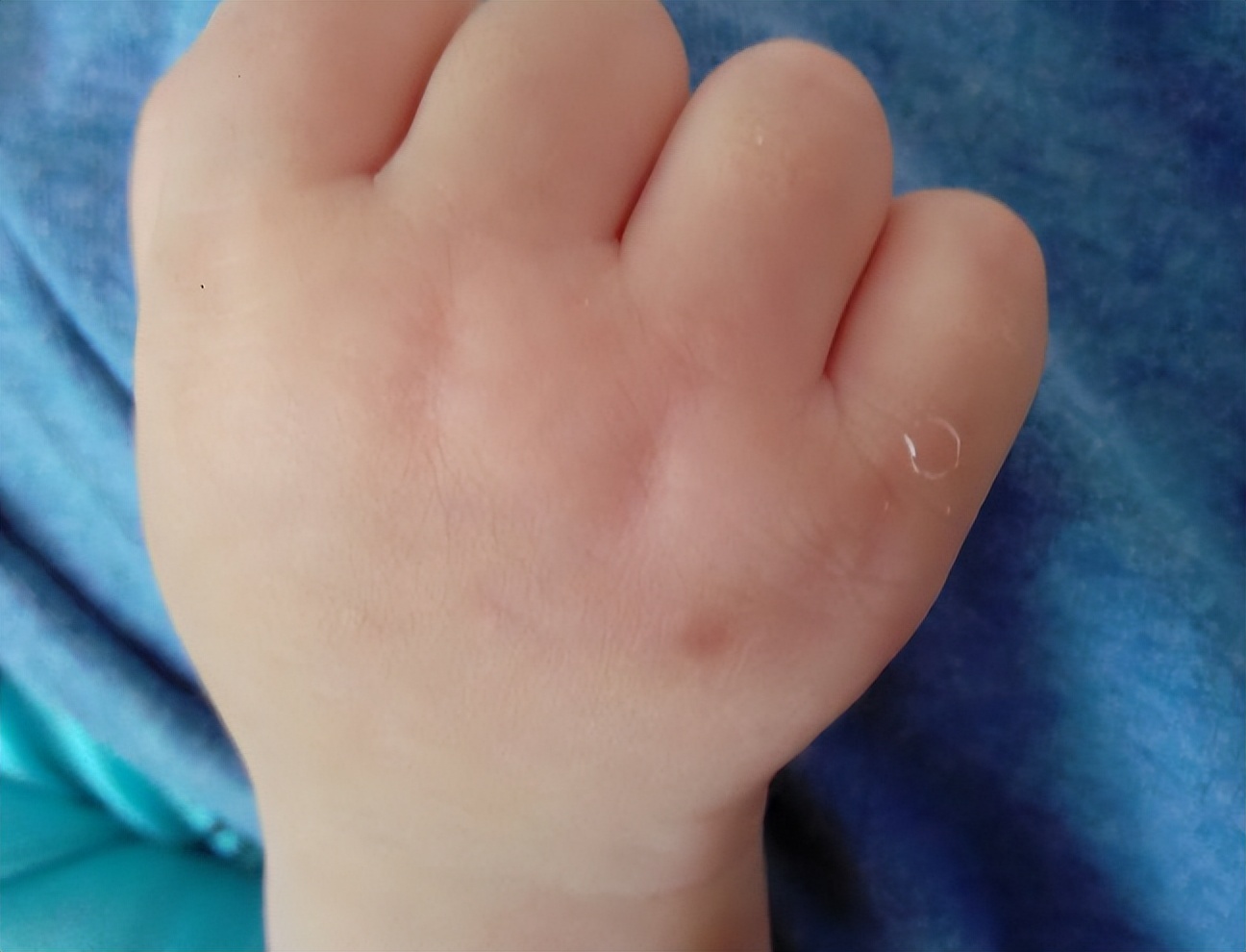 宝宝夏天很惹蚊子,宝宝被蚊子困扰