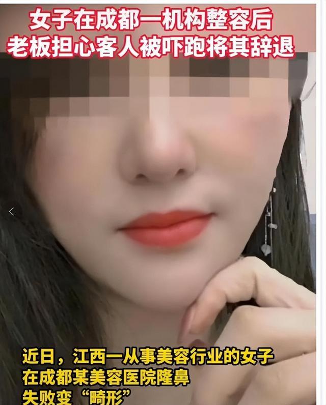 整容朝天鼻案例,朝天鼻整容成功案例