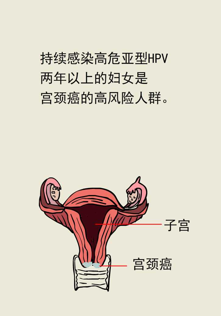女性经常有白带是什么原因引起的,女性白带增多像水一样