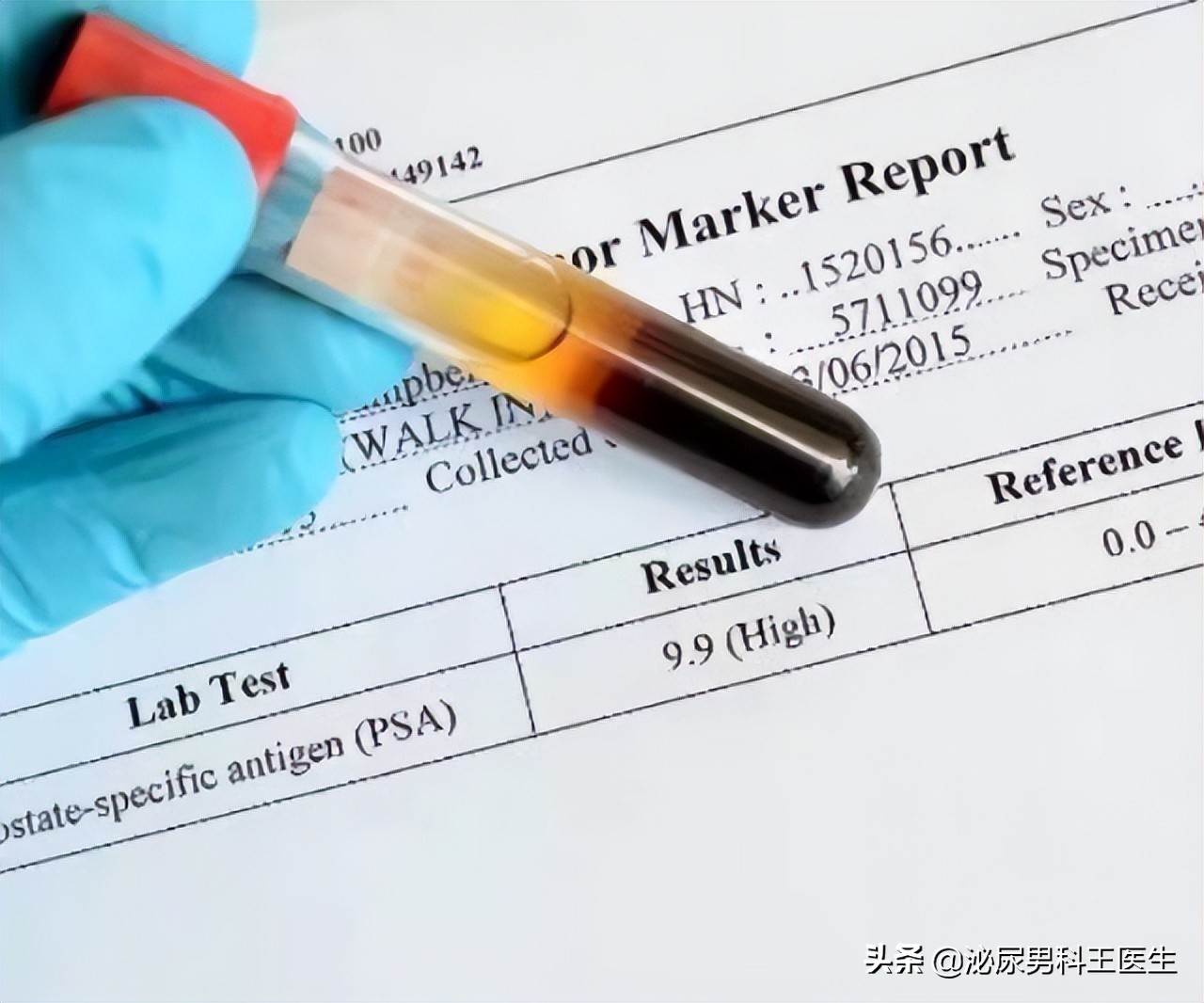 前列腺癌发现就是晚期？叶定伟教授：50岁以上最好每年检查一次