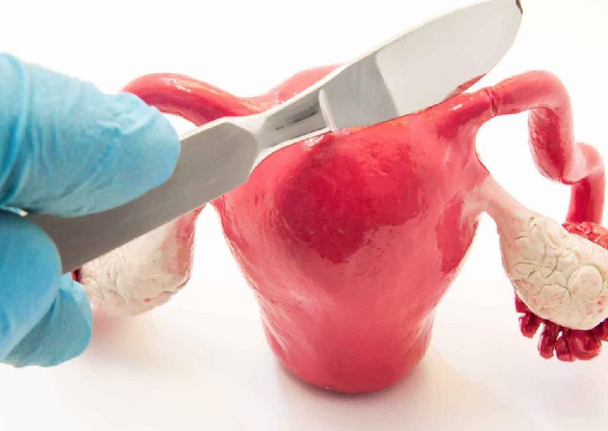 宫颈切除后会提前衰老吗,宫颈切除影响生活吗