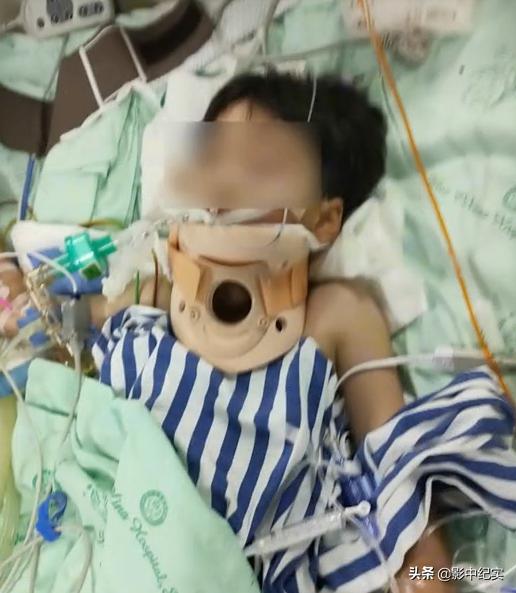 十岁的男孩开卡丁车追尾,10岁男孩玩卡丁车拦腰截瘫