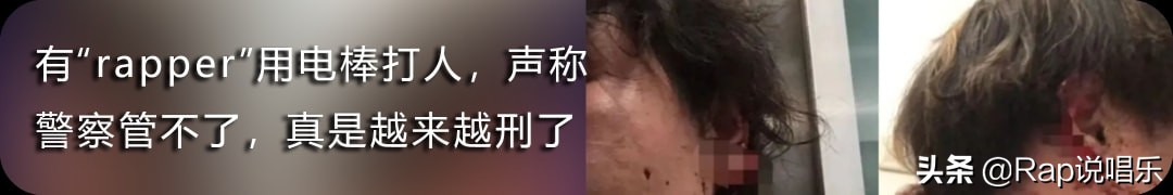 那奇沃夫jonyj实力,那奇沃夫dissjonyj