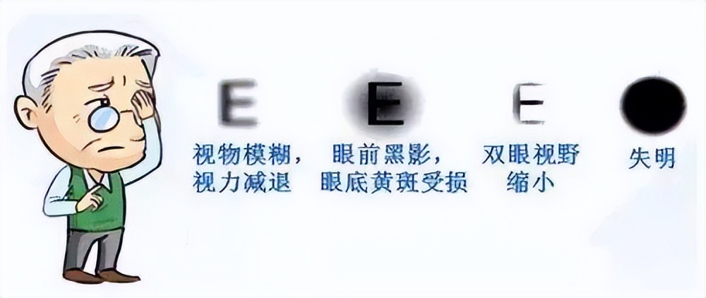 得了糖尿病可能会眼瞎？小心糖尿病视网膜病变