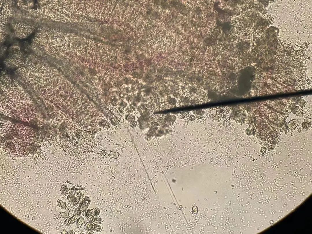 杯体虫在鮰鱼上面很常见,科学养殖塘鲺鱼苗