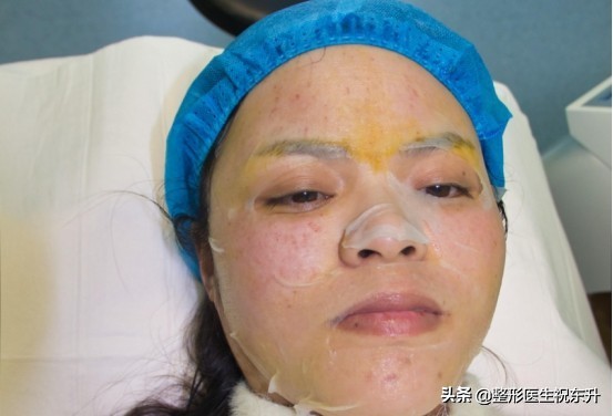 马上要回家过年了，给你们推荐一个能短期变美的整容项目：水光针