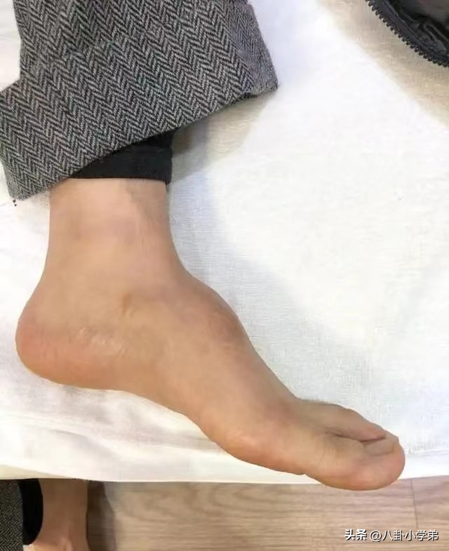 谢霆锋的手，黄晓明的脚，赵丽颖的血栓，让多少“流量明星”脸红