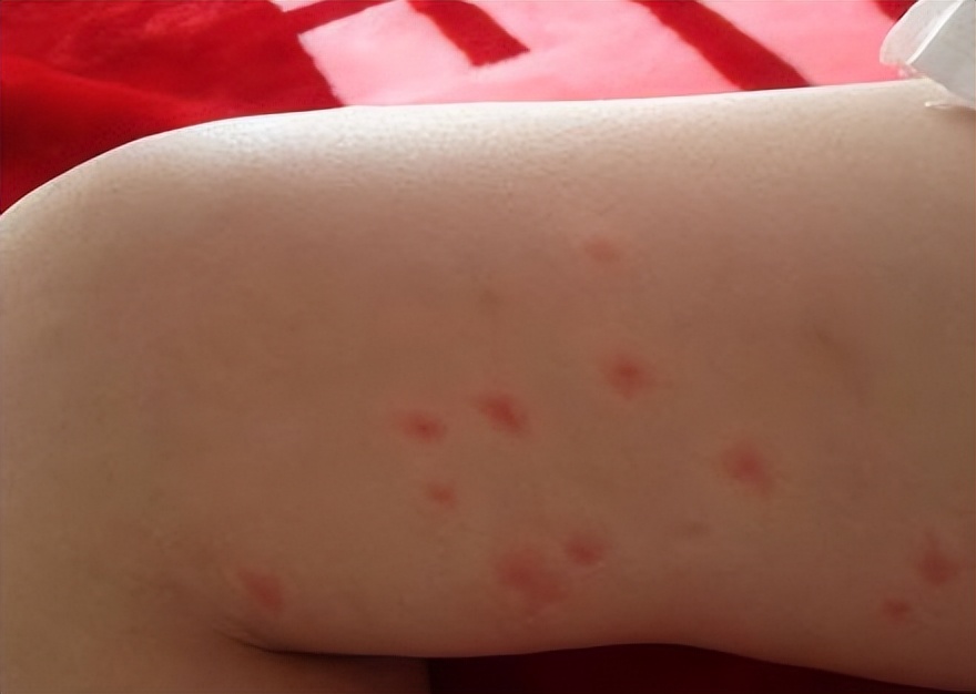 室内灭跳蚤的特效药,室内消灭跳蚤