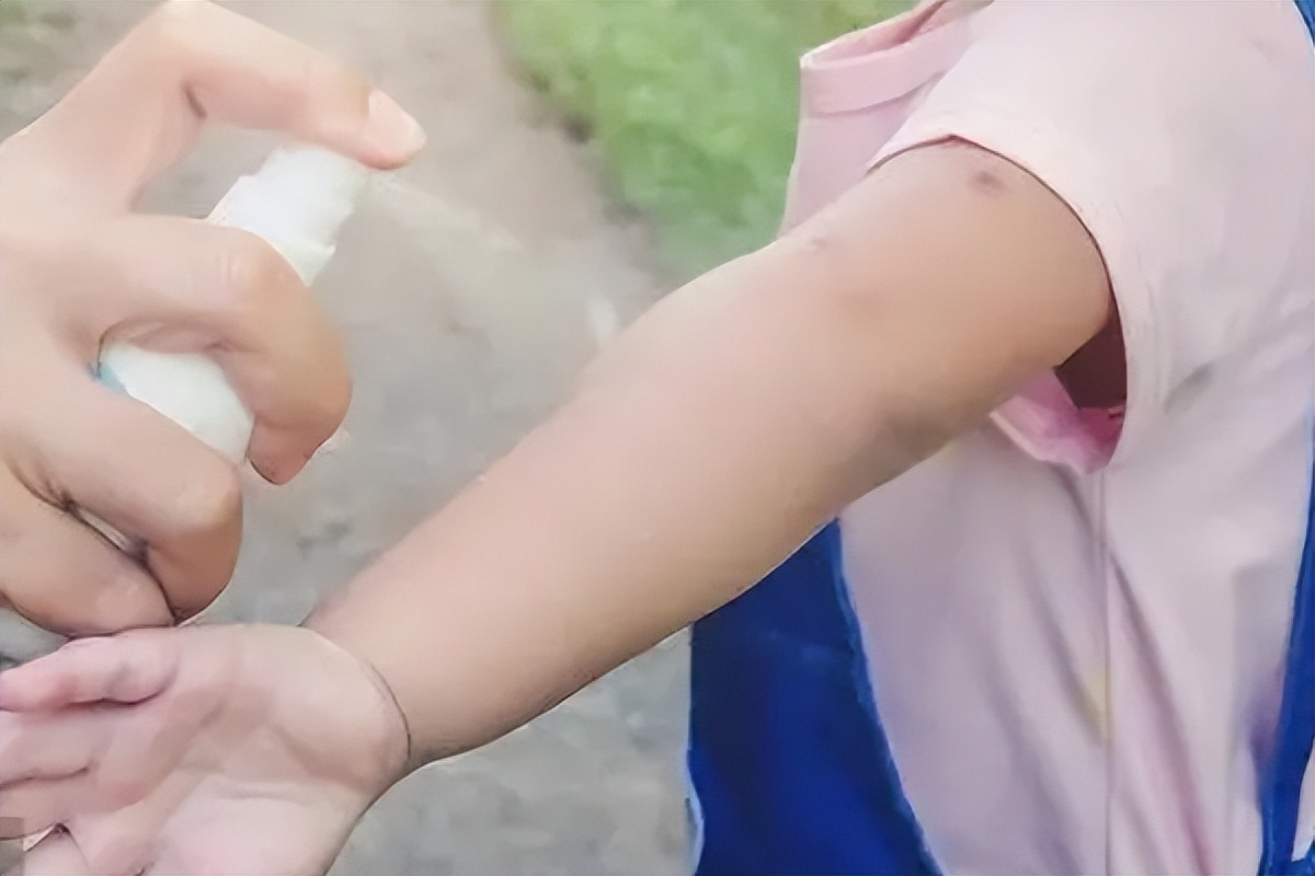 驱蚊液选什么好用,婴儿驱蚊液哪个牌子效果最好