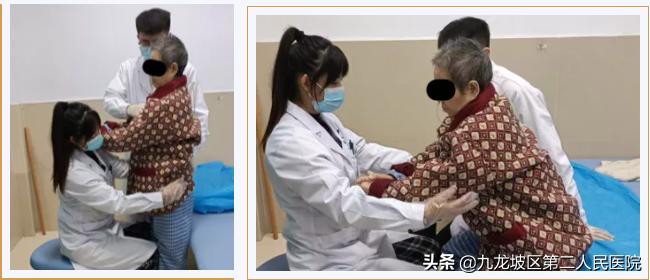 针灸能治疗好中风偏瘫吗,针灸康复中风