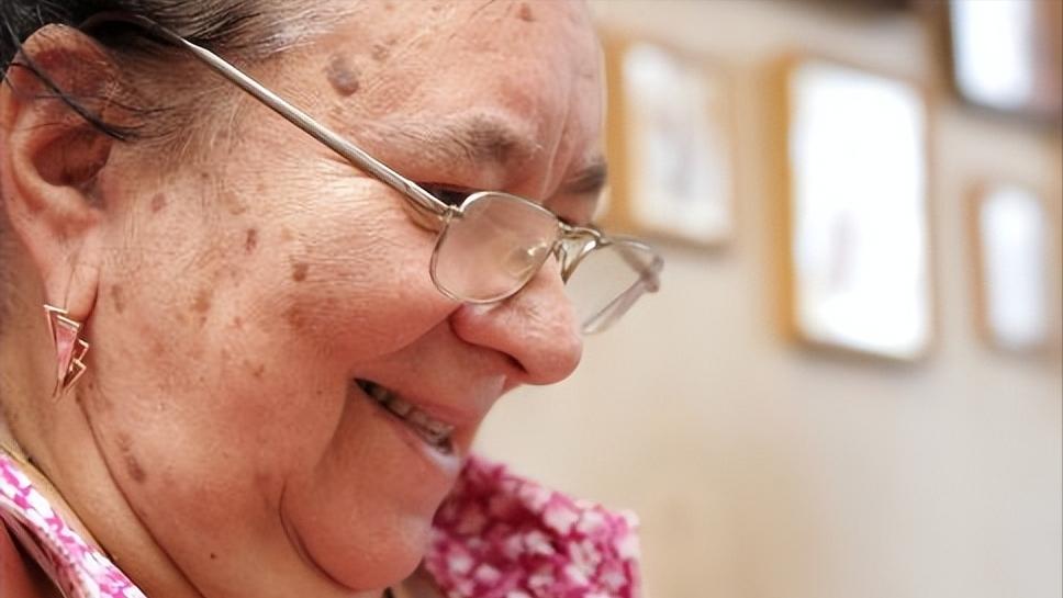 牙膏祛老年斑最好的克星,牙膏能去除老年斑是真的吗