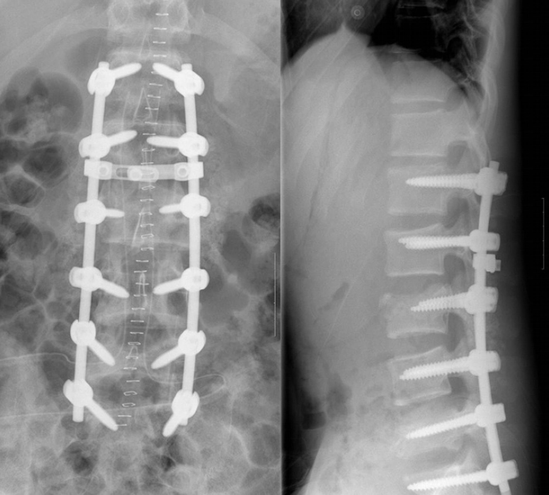 自杀前「被班主任打了一下叫道歉」，韩国校园霸凌折射的畸形社会