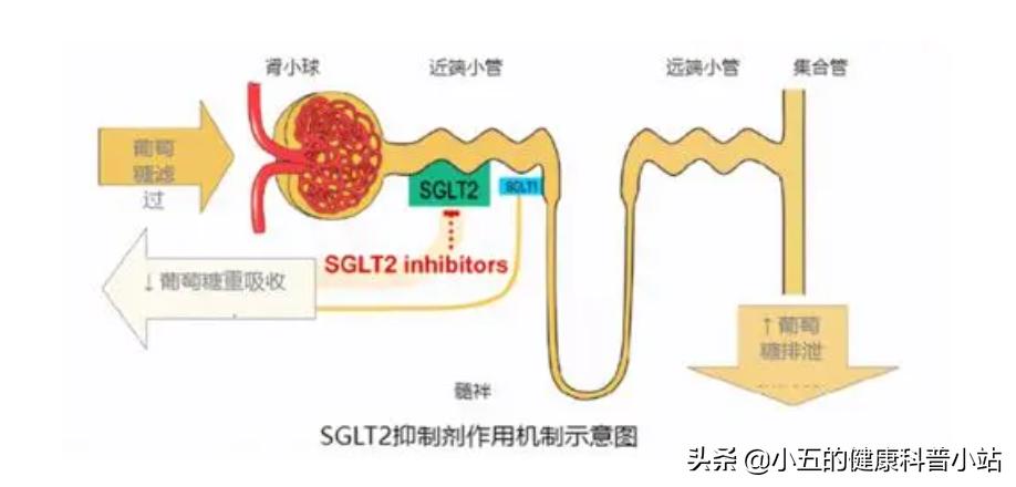 糖尿病长期吃药肾受损怎么办,糖尿病如何损伤血管的