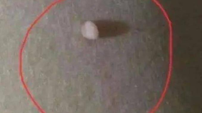 脖子和腋窝下的小肉粒怎么去除,脖子和腋下的小肉粒是啥