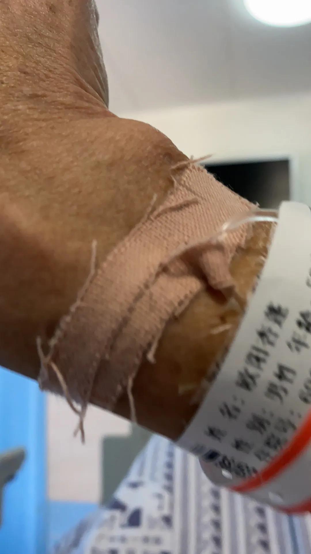 脑梗记忆力减退反应迟钝怎么恢复,脑梗记忆力