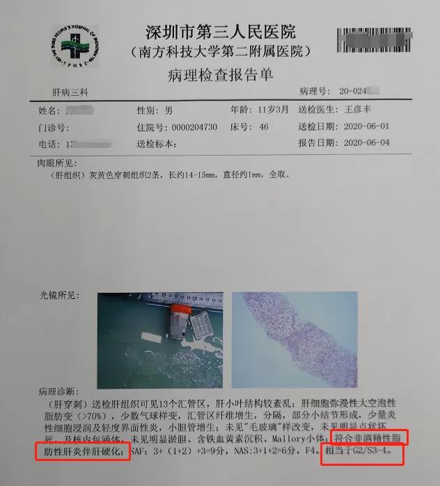 13岁男孩冬天不愿穿短裤,13岁男孩不愿意去澡堂