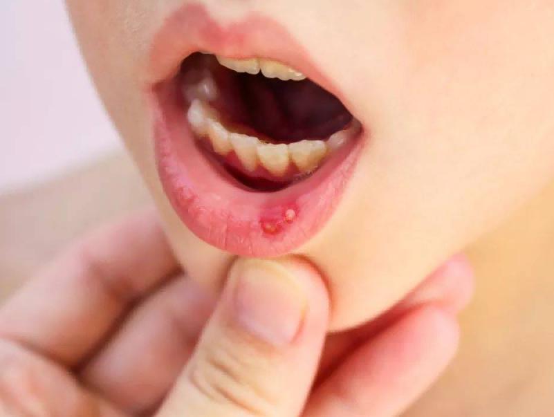 两三块钱一瓶的维生素b2有用吗,几块钱维生素b2功效与作用