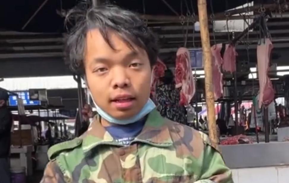 坚强的三口之家:现实版美女与野兽,肤白貌美小娇妻,嫁给袖珍男