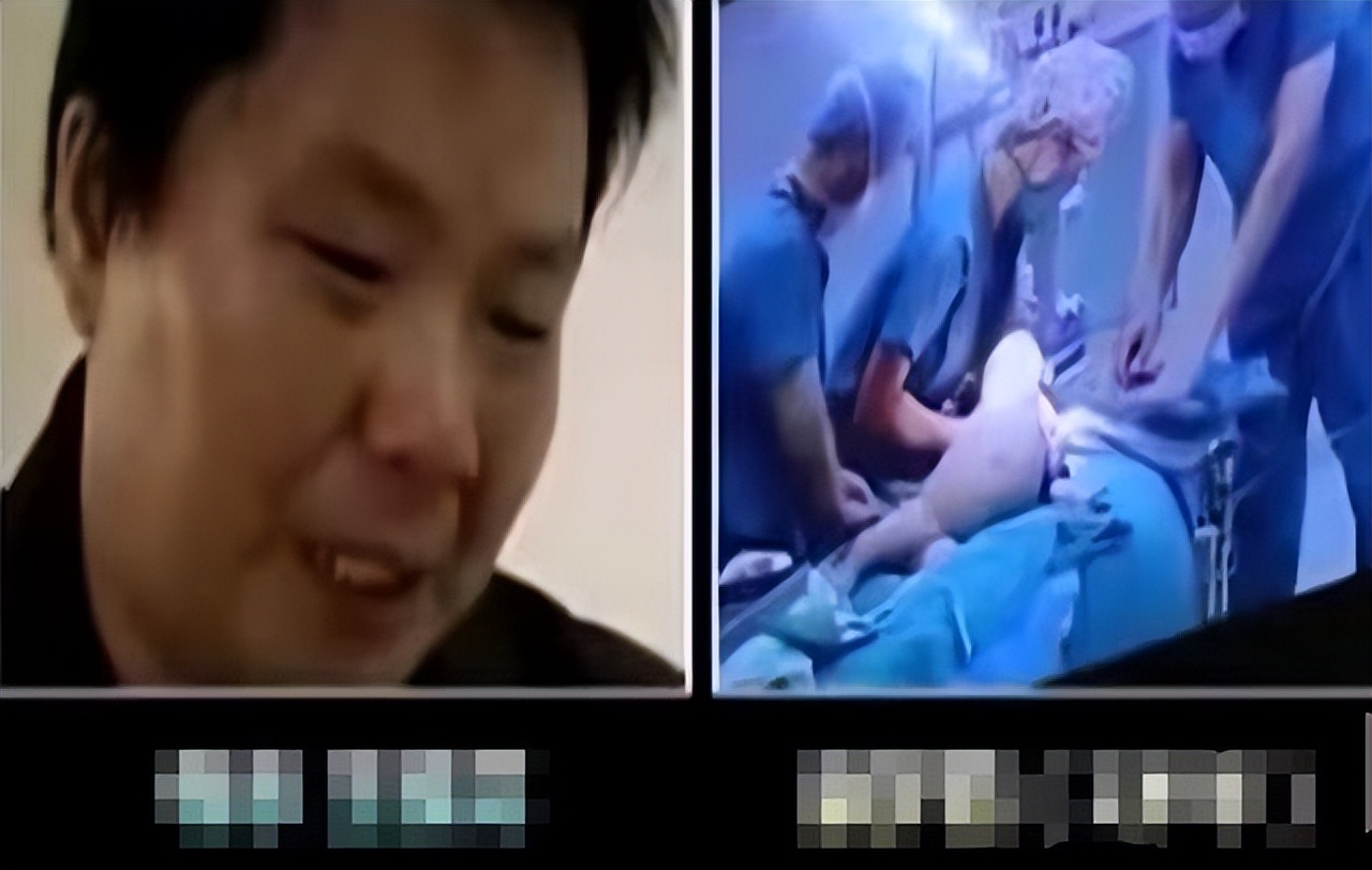 女童肚子超大疑似怀孕,2岁女婴肚中发现“胎儿”