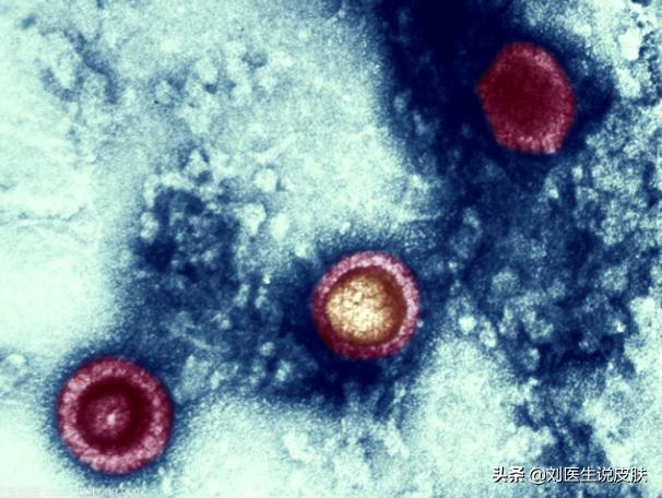 大吃大喝导致的上火怎么办,春节期间嘴巴上火怎么回事