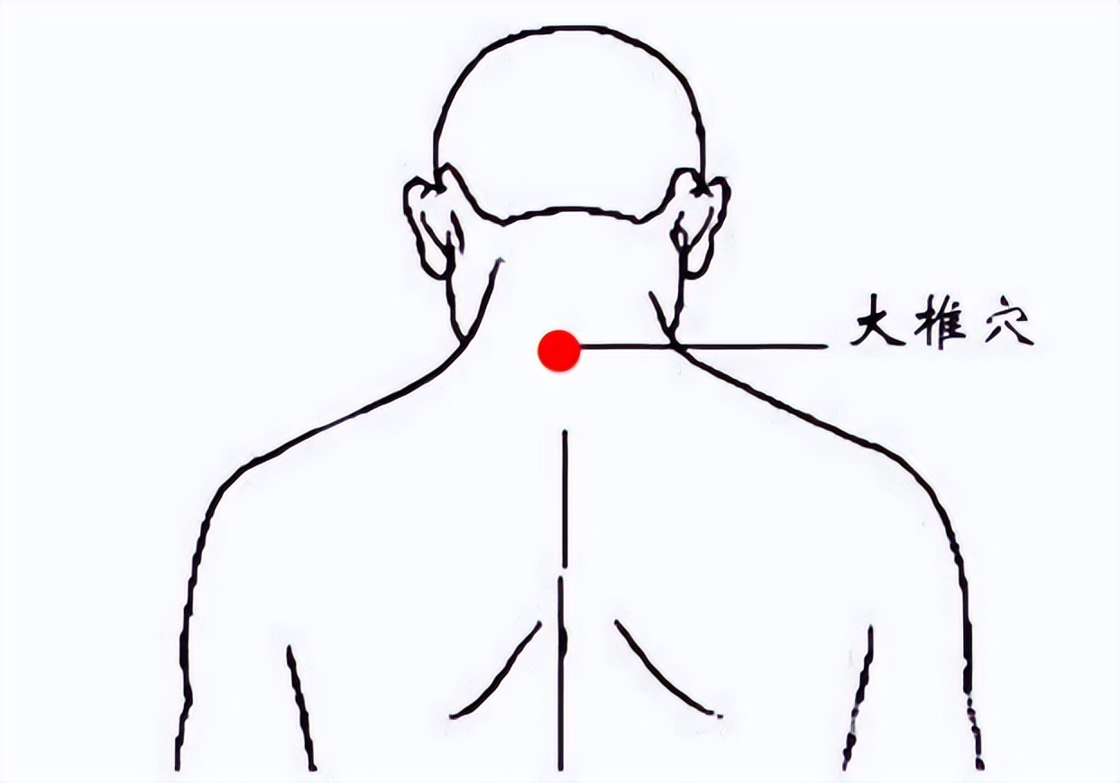 老中医预防肺炎型冠状病毒,山西中医治疗新型冠状病毒感染